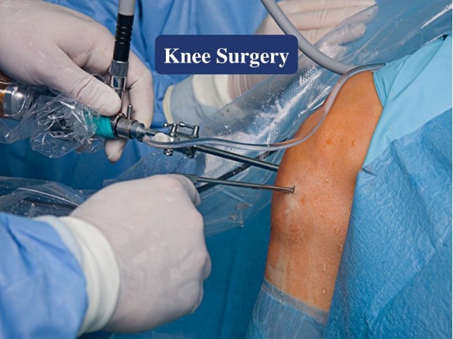 Knee Surgery