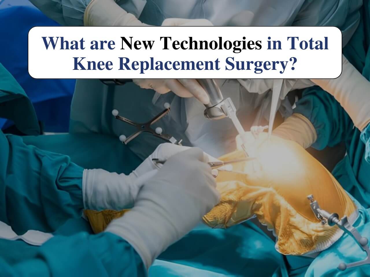 New Technologies in Total Knee Replacement Surgery