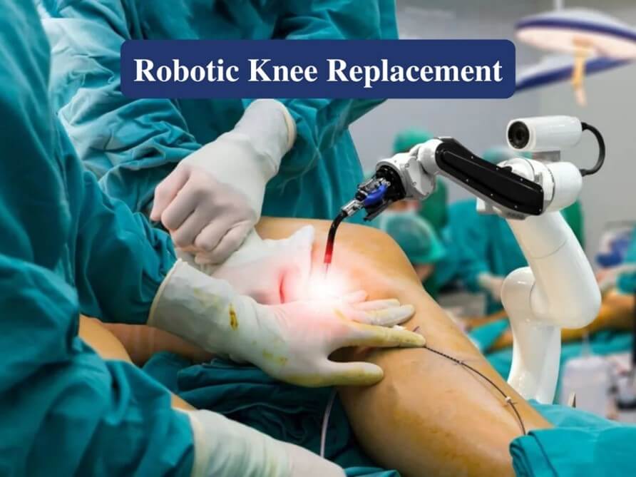 Robotic Knee Replacement