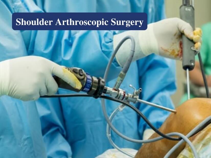 Shoulder Arthroscopic surgery