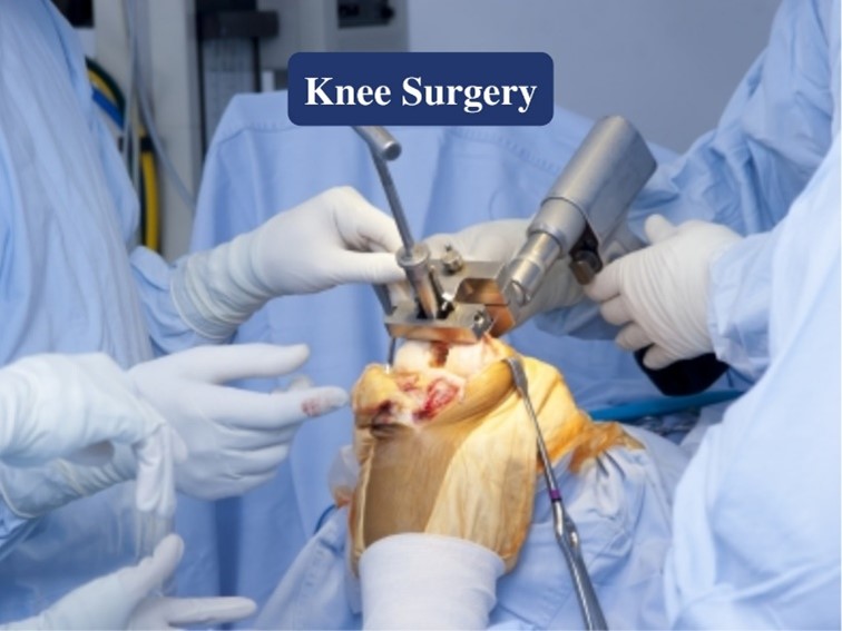 Total knee surgery