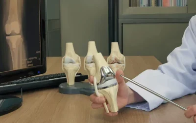 What is Joint Replacement Surgery?