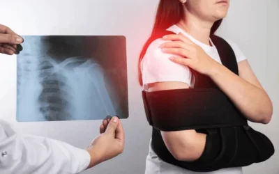 Shoulder Arthroscopy Surgery Recovery Timeline