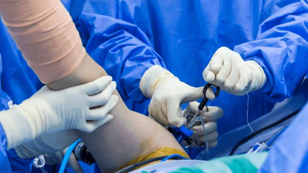 Shoulder Arthroscopy Surgery Recovery Shoulder Arthroscopy Surgery Recovery