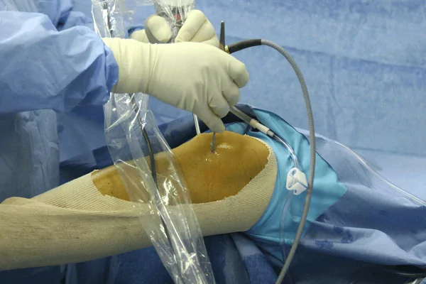 Why Arthroscopy is Revolutionizing Joint Surgery in 2025?