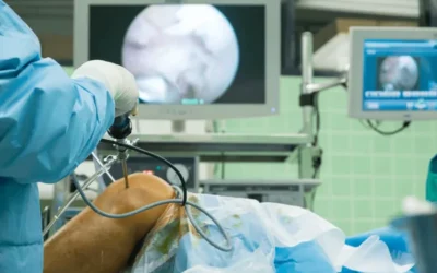 What to Expect During and After Arthroscopy Surgery?