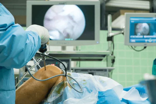Arthroscopy Surgery