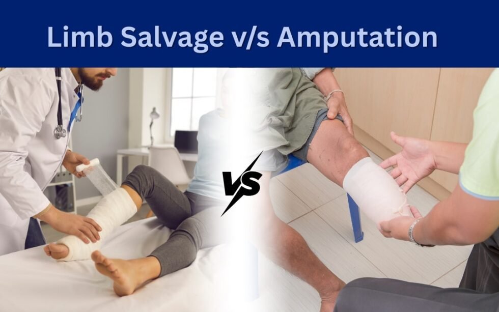 Limb Salvage vs Amputation Explained: Risks, Benefits & Recovery