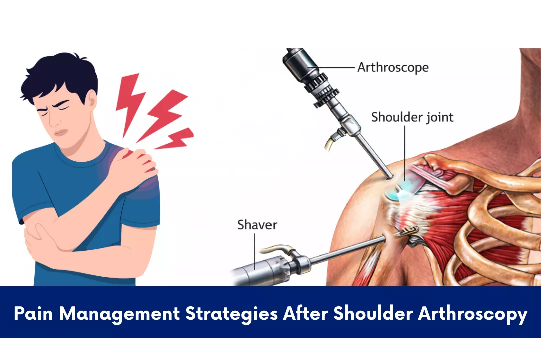 pain-management-strategies-after-shoulder-arthroscopy