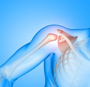 Shoulder Arthroscopy Surgey