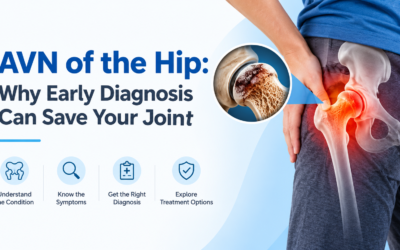 AVN of the Hip: Why Early Diagnosis Can Save Your Joint